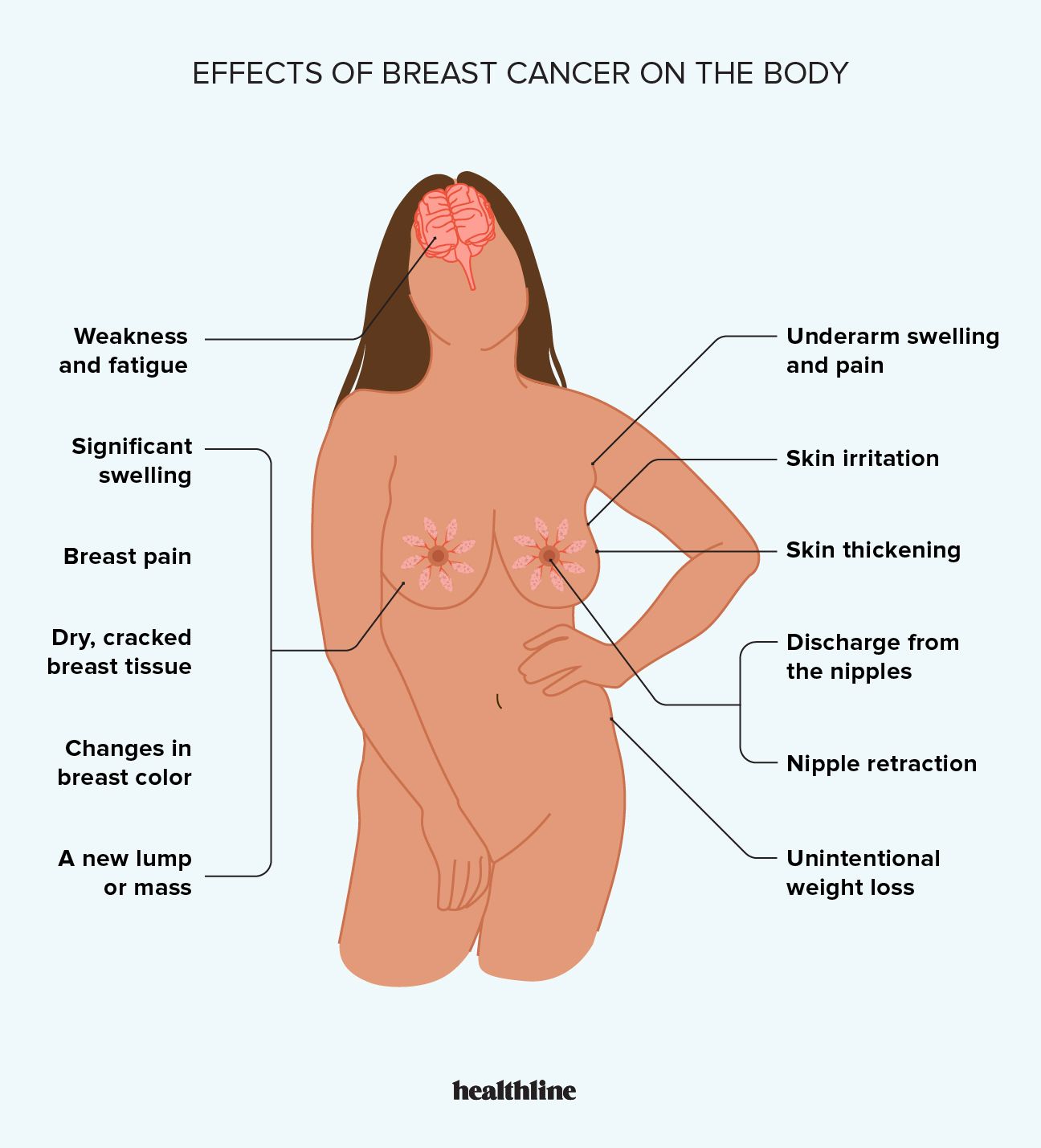Effects if breast cancer on the body